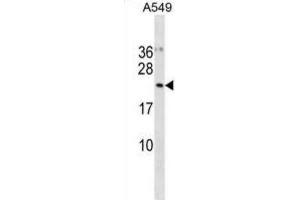Western Blotting (WB) image for anti-Ubiquitin-Fold Modifier Conjugating Enzyme 1 (UFC1) antibody (ABIN3001127) (UFC1 抗体)