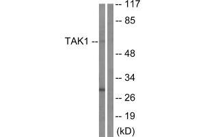 Western blot analysis of extracts from HepG2 cells, using TAK1 (epitope around residue 184) antibody. (TR4 抗体  (Thr184))