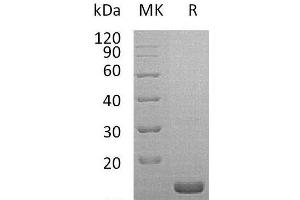 Western Blotting (WB) image for Interleukin 1 Receptor Antagonist (IL1RN) protein (ABIN7320549) (IL1RN 蛋白)