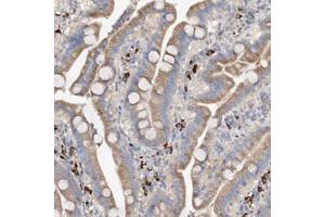 Immunohistochemical staining (Formalin-fixed paraffin-embedded sections) of human duodenum with SLC5A11 polyclonal antibody  shows moderate cytoplasmic positivity in glandular cells. (Solute Carrier Family 5 (Sodium/inositol Cotransporter), Member 11 (SLC5A11) 抗体)