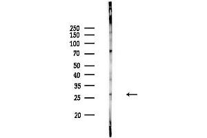 anti-RAB12, Member RAS Oncogene Family (RAB12) (C-Term) antibody