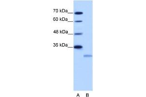WB Suggested Anti-EIF4E2 Antibody Titration:  2. (EIF4E2 抗体  (N-Term))
