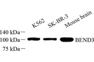 Western blot analysis of BEND3 (ABIN7073204) at dilution of 1: 500 (BEND3 抗体)