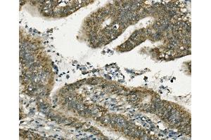 IHC analysis of FABP6 using anti-FABP6 antibody (ABIN7598974). (FABP6 抗体  (AA 1-128))