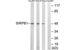 Western Blotting (WB) image for anti-Signal-Regulatory Protein beta 1 (SIRPB1) (AA 231-280) antibody (ABIN2890636) (SIRPB1 抗体  (AA 231-280))