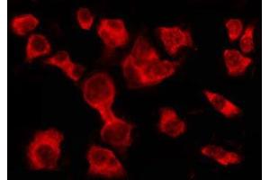 Immunofluorescence (fixed cells) (IF/ICC) image for anti-Olfactory Receptor, Family 2, Subfamily A, Member 25 (OR2A25) antibody (ABIN6263848)