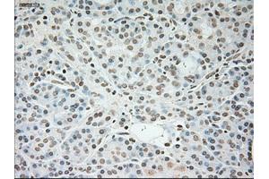 Immunohistochemical staining of paraffin-embedded pancreas tissue using anti-TNNI3mouse monoclonal antibody. (TNNI3 抗体  (AA 1-210))
