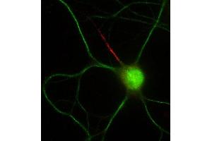 Double immunofluorescence staining of cultured rat hippocampal neurons with N56/21 (red) and MAP2 (green).