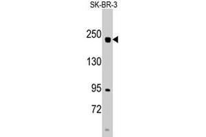 Western blot analysis of RICTOR polyclonal antibody  in SK-BR-3 cell line lysates (35 ug/lane). (RICTOR 抗体  (N-Term))