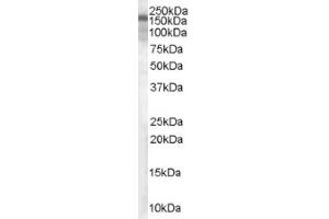 Image no. 1 for anti-Tuberous Sclerosis 1 (TSC1) (C-Term), (Isoform 1) antibody (ABIN374676) (TSC1 抗体  (C-Term, Isoform 1))