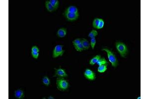 Immunofluorescent analysis of MCF-7 cells using ABIN7163997 at dilution of 1:100 and Alexa Fluor 488-congugated AffiniPure Goat Anti-Rabbit IgG(H+L) (KCNH7 抗体  (AA 1-300))