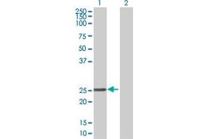 Western Blot analysis of CBX5 expression in transfected 293T cell line by CBX5 MaxPab polyclonal antibody. (CBX5 抗体  (AA 1-191))