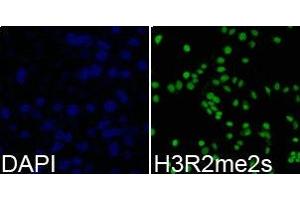 Immunofluorescence analysis of 293T cell using H3R2me2s antibody. (Histone 3 抗体  (H3R2me2s))