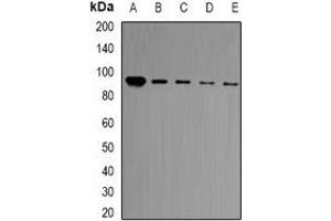 Western blot analysis of BCL11A expression in HT29 (A), Jurkat (B), Hela (C), A549 (D), mouse brain (E) whole cell lysates. (BCL11A 抗体)
