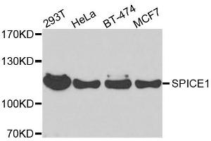 Western blot analysis of extracts of various cell lines, using SPICE1 antibody. (SPICE1 抗体  (AA 1-220))