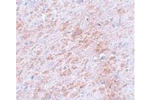 Immunohistochemistry (IHC) image for anti-Doublecortin-Like Kinase 2 (DCLK2) (C-Term) antibody (ABIN1030358) (DCLK2 抗体  (C-Term))