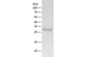 Decapping Enzyme, Scavenger (DCPS) (AA 1-337) protein (His-IF2DI Tag)