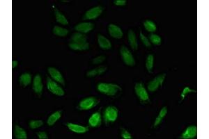 Immunofluorescent analysis of Hela cells using ABIN7160707 at dilution of 1: 100 and Alexa Fluor 488-congugated AffiniPure Goat Anti-Rabbit IgG(H+L) (NPL 抗体  (AA 17-77))