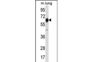 POF1B Antibody (Center) (ABIN657749 and ABIN2846733) western blot analysis in mouse lung tissue lysates (35 μg/lane). (POF1B 抗体  (AA 337-366))