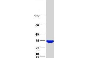 Western Blotting (WB) image for PSME3 (PSME3) (Transcript Variant 1) protein (Myc-DYKDDDDK Tag) (ABIN2730011)