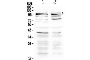 Western blot analysis of TRPC3 using anti-TRPC3 antibody . (TRPC3 抗体  (AA 718-770))