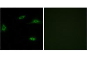 Immunofluorescence analysis of LOVO cells, using OR2T11 Antibody. (OR2T11 抗体  (AA 51-100))