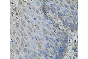 Immunohistochemistry of paraffin-embedded Human esophagus using IL1A Polyclonal Antibody at dilution of 1:100 (40x lens). (IL1A 抗体)
