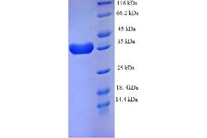 SDS-PAGE (SDS) image for Eukaryotic Translation Initiation Factor 4E Binding Protein 2 (EIF4EBP2) (AA 1-120), (full length) protein (GST tag) (ABIN5709455)