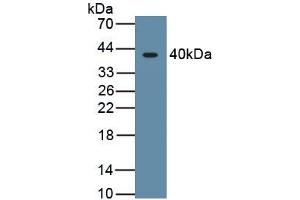 Detection of Recombinant HIF1a, Human using Monoclonal Antibody to Hypoxia Inducible Factor 1 Alpha (HIF1a) (HIF1A 抗体  (AA 218-506))