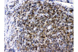 Immunohistochemistry (IHC) image for anti-rho Guanine Nucleotide Exchange Factor (GEF) 1 (ARHGEF1) (AA 41-71), (N-Term) antibody (ABIN4886475)