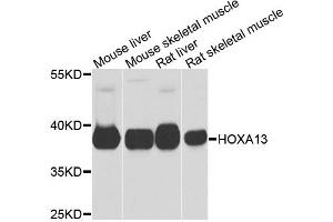 Western blot analysis of extracts of various cell lines, using HOXA13 antibody. (HOXA13 抗体)
