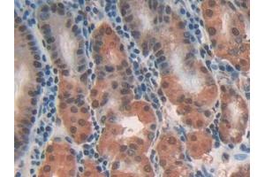 Detection of CLIC1 in Human Stomach Tissue using Polyclonal Antibody to Chloride Intracellular Channel Protein 1 (CLIC1) (CLIC1 抗体  (AA 79-241))