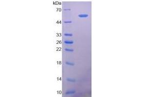 SDS-PAGE analysis of Human 5'-Nucleotidase, Ecto Protein. (CD73 蛋白)