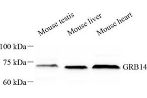 Western blot analysis of GRB14 (ABIN7074135) at dilution of 1: 500 (GRB14 抗体)