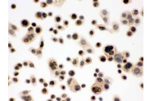 Immunohistochemistry (IHC) image for anti-Nibrin (NBN) (AA 714-745), (C-Term) antibody (ABIN3043282)
