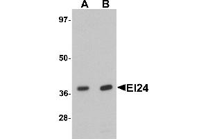 Western blot analysis of EI24 in rat liver tissue lysate with EI24 antibody at (A) 1 and (B) 2 µg/mL.