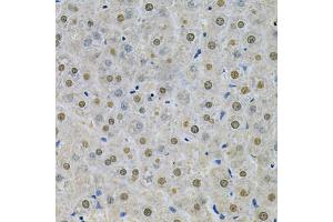 Immunohistochemistry of paraffin-embedded rat liver using SPHK1 Antibody (ABIN5970017) at dilution of 1/200 (40x lens). (SPHK1 抗体)