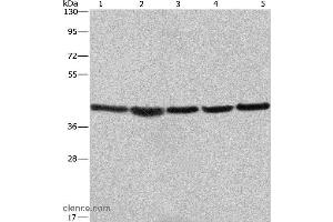 Western blot analysis of A549, NIH/3T3 and 293T cell? (RPSA/Laminin Receptor 抗体)