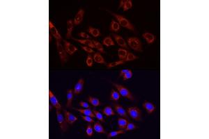 Immunofluorescence analysis of NIH/3T3 cells using PI3 Kinase p85 alpha antibody (ABIN6130617, ABIN6145642, ABIN6145645 and ABIN6215197) at dilution of 1:100. (PIK3R1 抗体  (AA 240-380))