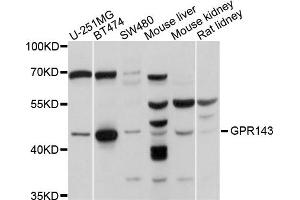 Western blot analysis of extracts of various cells, using GPR143 antibody. (GPR143 抗体)
