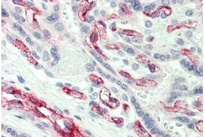 anti-Caspase 2, Apoptosis-Related Cysteine Peptidase (CASP2) (N-Term) antibody