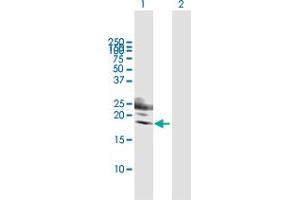 Western Blotting (WB) image for anti-Killer Cell Lectin-Like Receptor Subfamily G, Member 1 (KLRG1) (AA 1-189) antibody (ABIN523619)