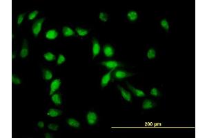 Immunofluorescence of monoclonal antibody to API5 on HeLa cell. (Apoptosis Inhibitor 5 抗体  (AA 400-504))