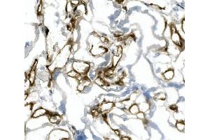 IHC analysis of CD31/PECAM1 using anti-CD31/PECAM1 antibody (ABIN7601076). (CD31 抗体  (AA 28-382))