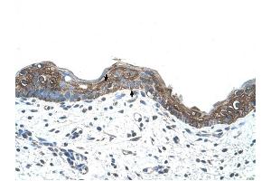Ankyrin 1 antibody was used for immunohistochemistry at a concentration of 4-8 ug/ml to stain Squamous epithelial cells (arrows) in Human Skin. (Erythrocyte Ankyrin 抗体  (C-Term))