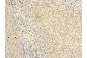 Immunohistochemistry of paraffin-embedded human tonsil tissue using ABIN7161534 at dilution of 1:100 (NKIRAS2 抗体  (AA 1-191))