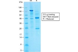 SDS-PAGE Analysis of Purified CA19-9 Rabbit Monoclonal Antibody (CA19. (CA 19-9 抗体)