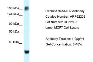 Western Blotting (WB) image for anti-ATPase Family, AAA Domain Containing 2 (ATAD2) (C-Term) antibody (ABIN2789063) (ATAD2 抗体  (C-Term))