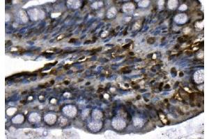 IHC analysis of MCM4 using anti-MCM4 antibody (ABIN7601485). (MCM4 抗体  (AA 361-677))