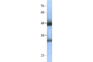 Western Blotting (WB) image for anti-General Transcription Factor IIH, Polypeptide 4, 52kDa (GTF2H4) (C-Term) antibody (ABIN2780372)